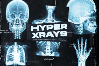 Hyper XRays Collection