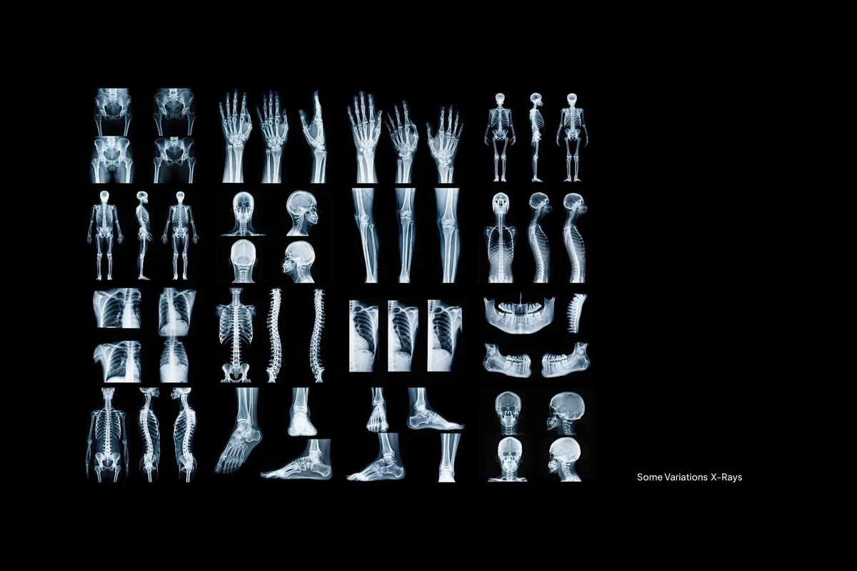 Hyper XRays Collection