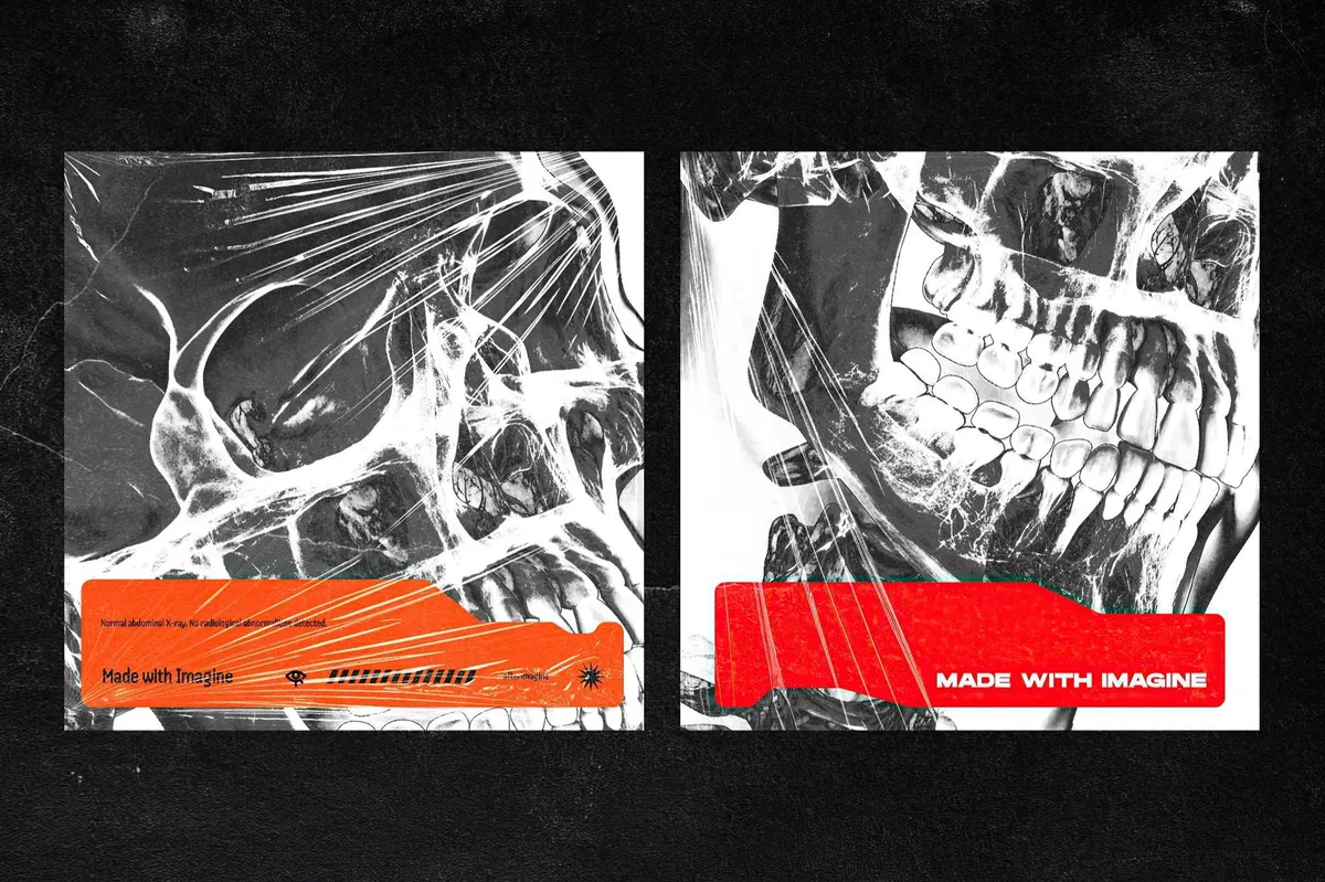 Hyper XRays Collection