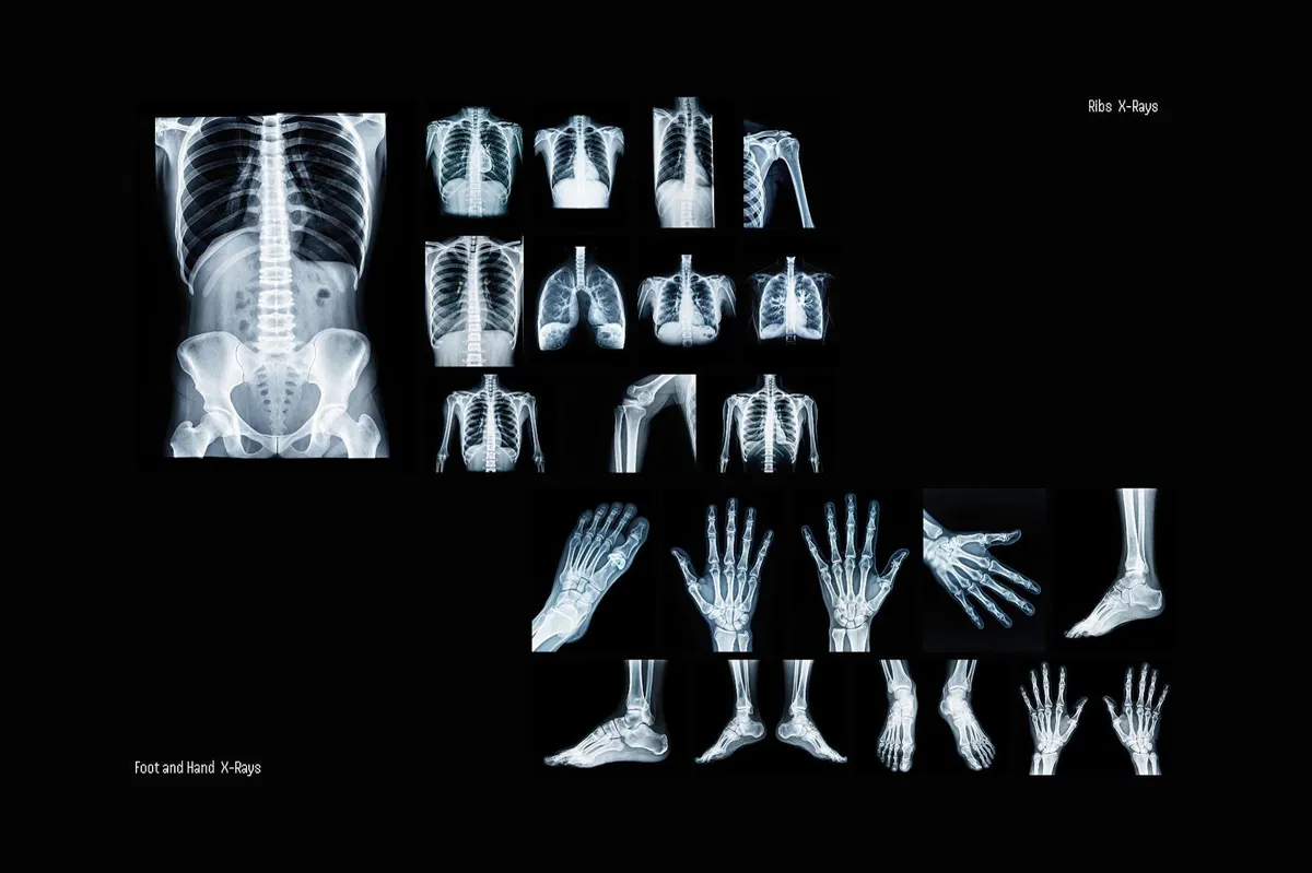 Hyper XRays Collection