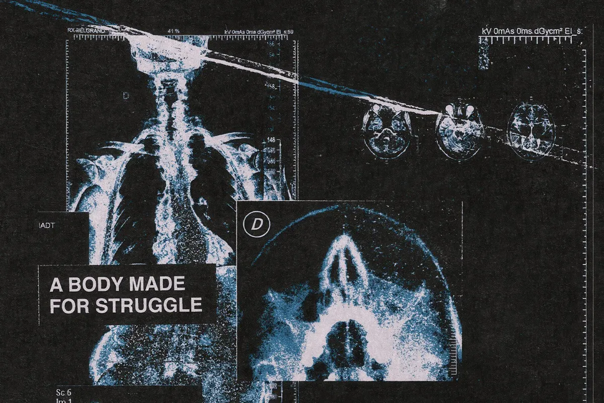X-Rays Image Pack
