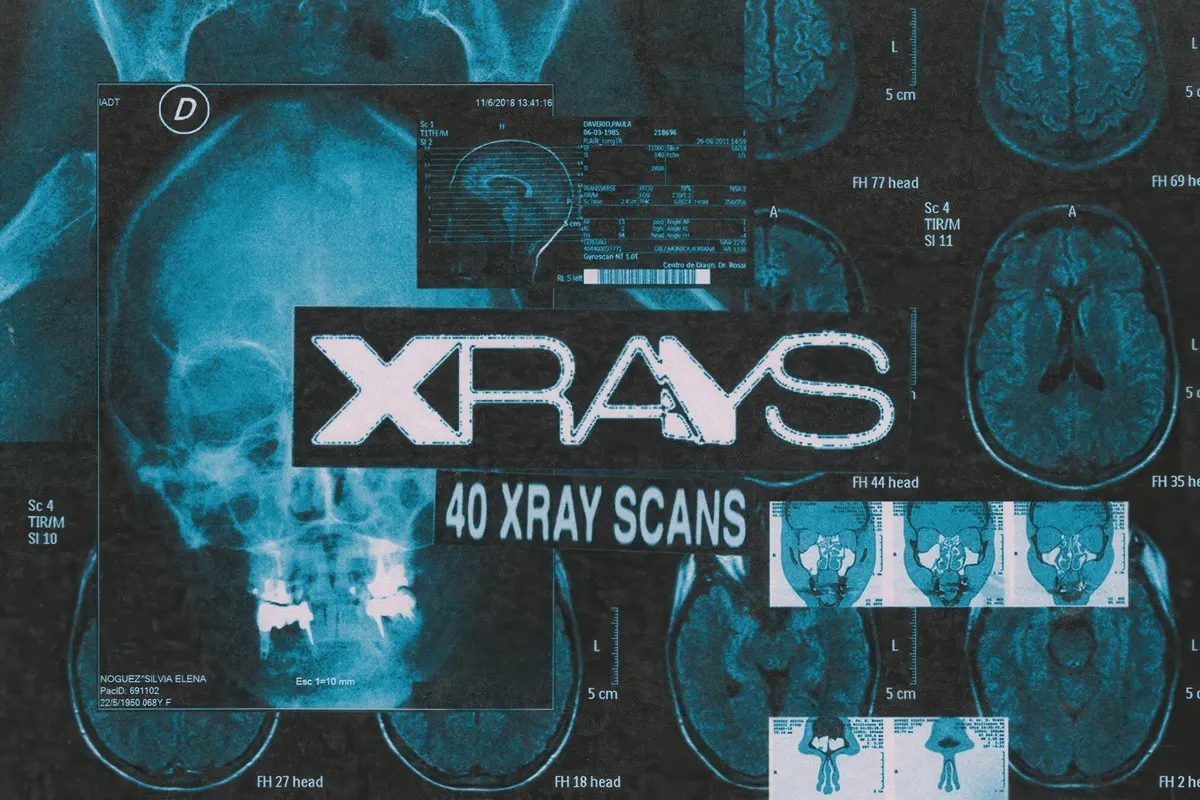 X-Rays Image Pack