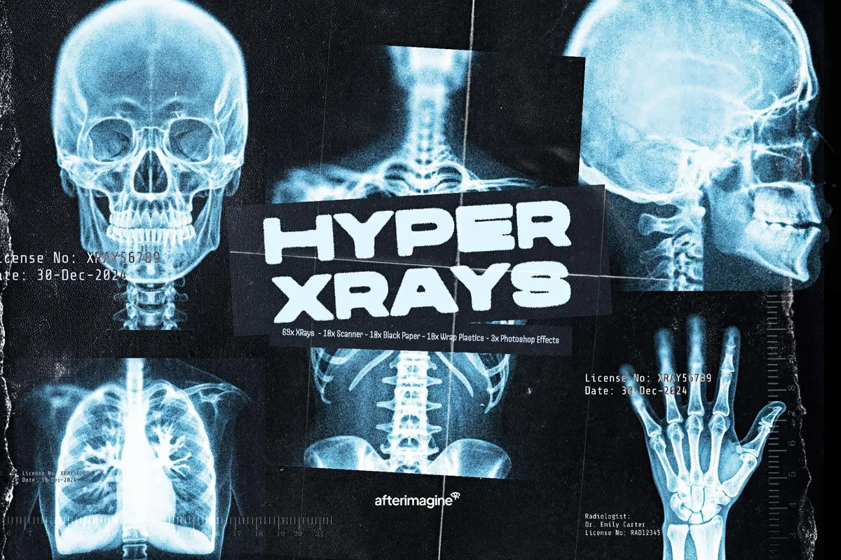 Hyper XRays Collection