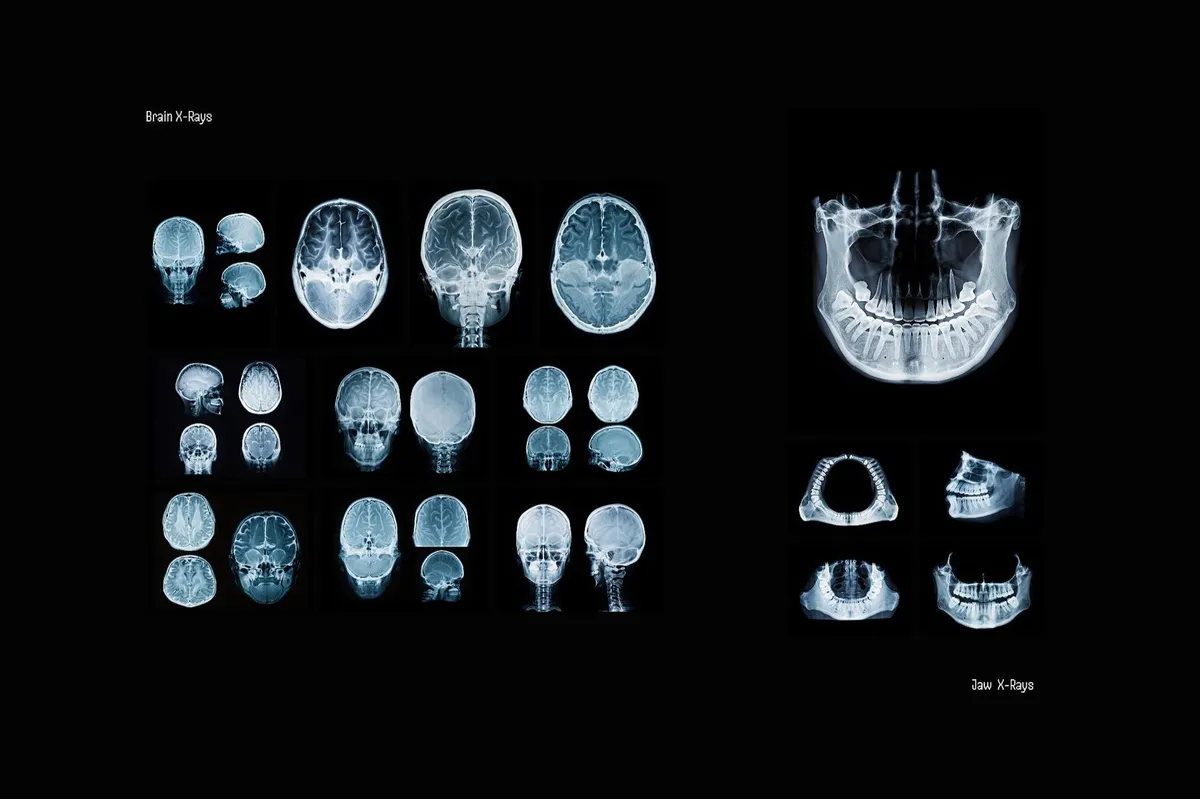 Hyper XRays Collection