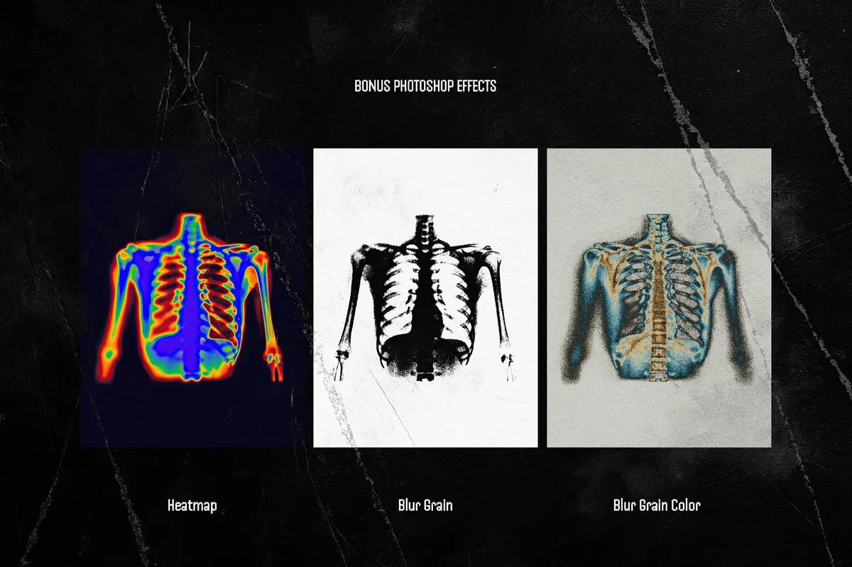 Hyper XRays Collection
