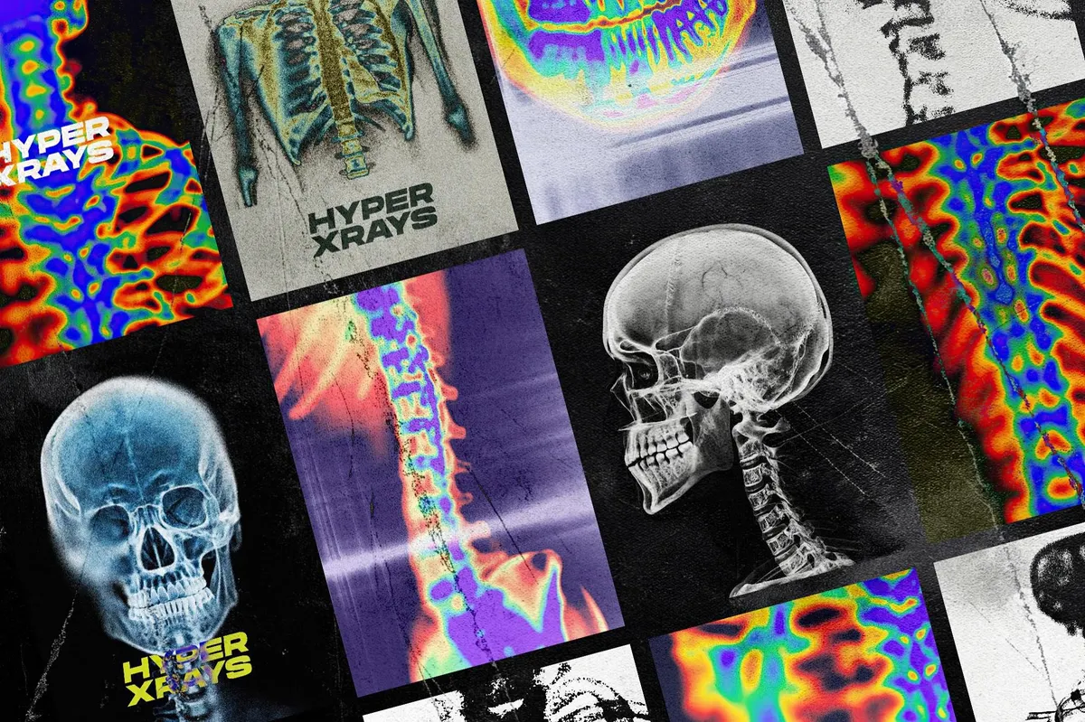 Hyper XRays Collection