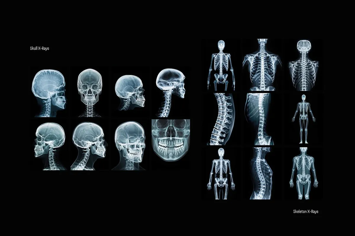 Hyper XRays Collection