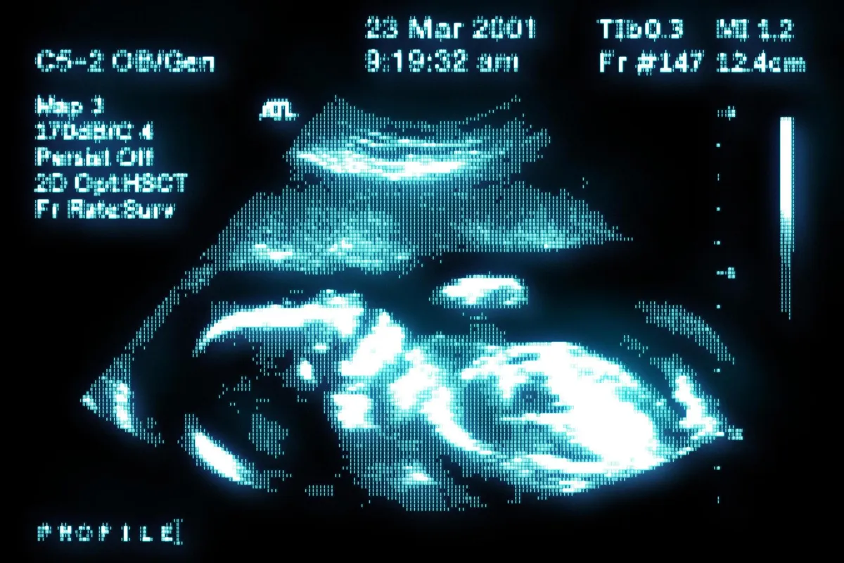 Analog Retro-Futuristic Monitor Effect