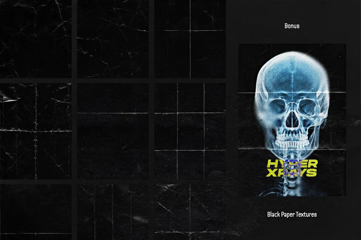 Hyper XRays Collection